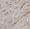 TNF Superfamily Member 12 antibody, NBP1-76695, Novus Biologicals, Immunohistochemistry paraffin image 
