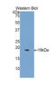 Retinol Binding Protein 7 antibody, LS-C297776, Lifespan Biosciences, Western Blot image 