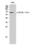 PDZ And LIM Domain 5 antibody, A03763Y251-1, Boster Biological Technology, Western Blot image 