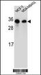 Secretion Associated Ras Related GTPase 1B antibody, 55-163, ProSci, Western Blot image 