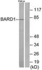 BRCA1 Associated RING Domain 1 antibody, TA313499, Origene, Western Blot image 