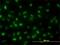 DNA Topoisomerase II Alpha antibody, H00007153-M01, Novus Biologicals, Immunofluorescence image 