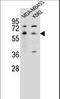 5-Hydroxytryptamine Receptor 3A antibody, LS-C165083, Lifespan Biosciences, Western Blot image 