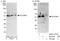 Histone-lysine N-methyltransferase SUV39H1 antibody, A302-127A, Bethyl Labs, Western Blot image 