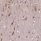 Importin 11 antibody, NBP2-49505, Novus Biologicals, Immunohistochemistry paraffin image 