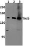 Tensin 3 antibody, PA5-75927, Invitrogen Antibodies, Western Blot image 