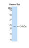 Desert Hedgehog Signaling Molecule antibody, LS-C294429, Lifespan Biosciences, Western Blot image 