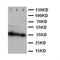 Homeobox A4 antibody, LS-C312758, Lifespan Biosciences, Western Blot image 