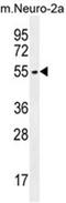 Zinc Finger DHHC-Type Containing 1 antibody, AP54634PU-N, Origene, Western Blot image 