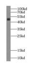 TDP43 antibody, FNab06401, FineTest, Western Blot image 