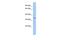 Family With Sequence Similarity 78 Member A antibody, PA5-70105, Invitrogen Antibodies, Western Blot image 