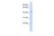 Interleukin-11 receptor subunit alpha antibody, GTX46436, GeneTex, Western Blot image 