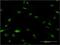 Nucleoporin 58 antibody, H00009818-M01, Novus Biologicals, Immunocytochemistry image 