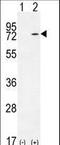 Lysyl-TRNA Synthetase antibody, LS-C165398, Lifespan Biosciences, Western Blot image 