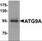 Autophagy Related 9A antibody, orb95544, Biorbyt, Western Blot image 