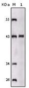 Sortilin Related Receptor 1 antibody, AM06185SU-N, Origene, Western Blot image 
