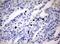 KI-67 antibody, TA802547S, Origene, Immunohistochemistry paraffin image 
