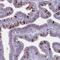 Phosphatidylinositol Transfer Protein Membrane Associated 1 antibody, PA5-63823, Invitrogen Antibodies, Immunohistochemistry frozen image 