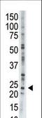 Adenylate Kinase 1 antibody, LS-C100930, Lifespan Biosciences, Western Blot image 