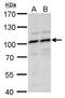 Myb Like, SWIRM And MPN Domains 1 antibody, GTX128254, GeneTex, Western Blot image 