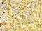 Actin Alpha 2, Smooth Muscle antibody, LS-C394736, Lifespan Biosciences, Immunohistochemistry paraffin image 