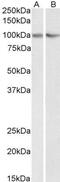 Tripartite Motif Containing 71 antibody, GTX88128, GeneTex, Western Blot image 