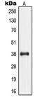 Nucleophosmin 1 antibody, MBS821855, MyBioSource, Western Blot image 