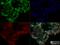 DNA Methyltransferase 3 Alpha antibody, NB120-13888, Novus Biologicals, Immunofluorescence image 