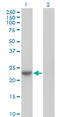 NME/NM23 Nucleoside Diphosphate Kinase 6 antibody, LS-C134018, Lifespan Biosciences, Western Blot image 
