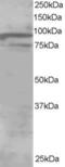 Oxysterol Binding Protein Like 11 antibody, 46-107, ProSci, Enzyme Linked Immunosorbent Assay image 