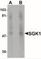 Serum/Glucocorticoid Regulated Kinase 1 antibody, NBP1-76578, Novus Biologicals, Western Blot image 
