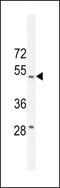 Reticulon 4 Interacting Protein 1 antibody, LS-C162795, Lifespan Biosciences, Western Blot image 