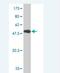 Glutathione S-transferase theta-1 antibody, H00002952-M01, Novus Biologicals, Western Blot image 