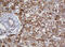 SERPINE1 MRNA Binding Protein 1 antibody, M04755, Boster Biological Technology, Immunohistochemistry paraffin image 