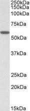 DIX Domain Containing 1 antibody, PA5-19232, Invitrogen Antibodies, Western Blot image 