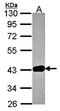 GRB2 Related Adaptor Protein 2 antibody, orb73608, Biorbyt, Western Blot image 