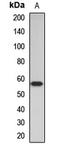 Activin A Receptor Type 2A antibody, LS-C667683, Lifespan Biosciences, Western Blot image 