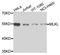 Mixed Lineage Kinase Domain Like Pseudokinase antibody, A5579, ABclonal Technology, Western Blot image 