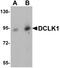 Doublecortin Like Kinase 1 antibody, NBP1-77127, Novus Biologicals, Western Blot image 