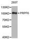 Pre-MRNA Processing Factor 6 antibody, STJ28904, St John