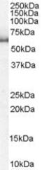 Karyopherin Subunit Alpha 1 antibody, PA5-18236, Invitrogen Antibodies, Western Blot image 