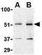 TRAF family member-associated NF-kappa-B activator antibody, GTX31741, GeneTex, Western Blot image 