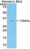 VICKZ family member 2 antibody, LS-C294644, Lifespan Biosciences, Western Blot image 