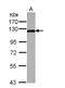 Mitogen-Activated Protein Kinase Kinase Kinase 12 antibody, NBP2-17218, Novus Biologicals, Western Blot image 