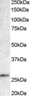 BAF Chromatin Remodeling Complex Subunit BCL7A antibody, EB05006, Everest Biotech, Western Blot image 