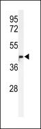 Methyltransferase Like 17 antibody, 64-217, ProSci, Western Blot image 