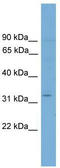 ETS Variant 2 antibody, TA341762, Origene, Western Blot image 