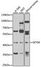 N-lysine methyltransferase SETD8 antibody, GTX33491, GeneTex, Western Blot image 