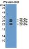 Interleukin 1 Receptor Antagonist antibody, LS-C663157, Lifespan Biosciences, Western Blot image 