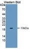 Phospholipase A2 Group IB antibody, LS-C374781, Lifespan Biosciences, Western Blot image 